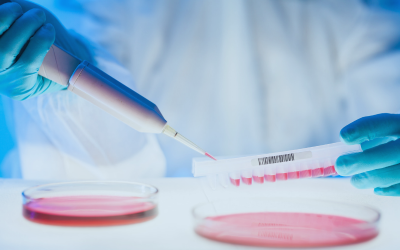 Prostate Cancer: How the BRCA Genetic Mutation Increases Your Risk