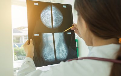 How Race to Track Mystery Gene with Links to Three Cancers Saved Millions