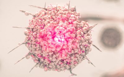 Christine McGuinness gets results from Myogenes breast cancer test